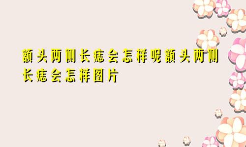 额头两侧长痣会怎样呢额头两侧长痣会怎样图片