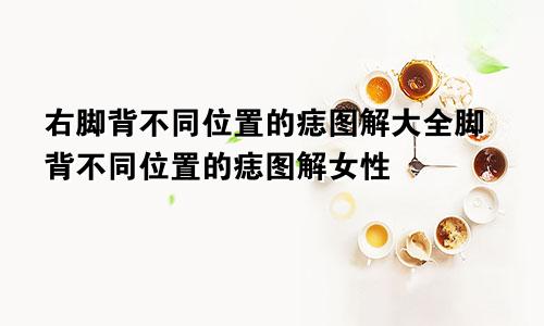 右脚背不同位置的痣图解大全脚背不同位置的痣图解女性